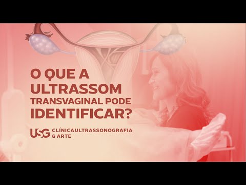 O que a Ultrassom Transvaginal pode Diagnósticar