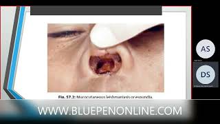 #parasitic #infection #skin #soft #tissue and #masculosketal #system #generalmedicine #medicine screenshot 5