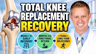 The Truth About Total Knee Replacement Recovery: A Surgeon's Timeline