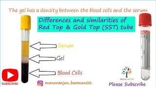 Red top vacutainer & Serum separator (Gold top) tube। Differences and similarities। Medical Lab Tech