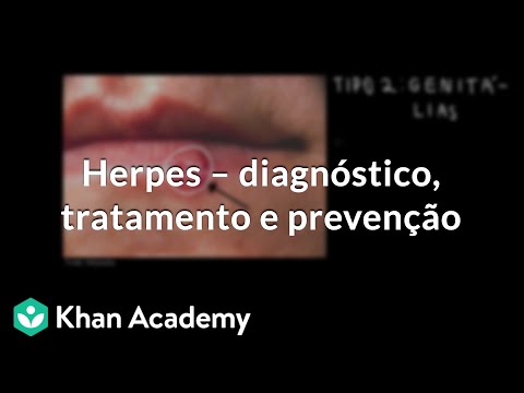 Vídeo: Esofagite Por Herpes: Sintomas, Diagnóstico E Tratamentos