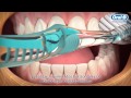 Técnica correcta para el cepillado de dientes | Oral B LT