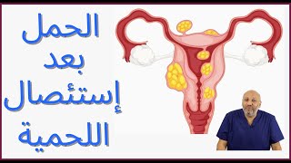 متي يحدث الحمل بعد إزالة أو إستئصال اللحمية ( الحلقة ١٠٩)