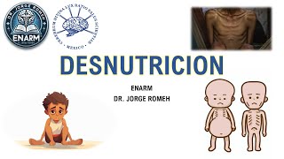 DESNUTRICION - ENARM - TODO LO QUE DEBES SABER