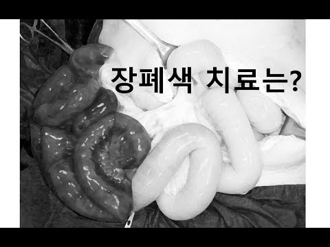 [#외과의사 ] #장폐색 이라는 #소장 이 막히는 병이 많습니다. #장폐색 #치료 는 어떻게 할까요?