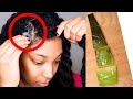 9 WAYS TO USE ALOE VERA GEL FOR HAIR GROWTH | GET THICKER HAIR