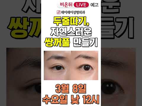 [비온뒤 예고] 두줄따기, 자연스러운 <strong>쌍꺼풀</strong> <strong>만들기</strong> - 유튜브 의학채널 &amp;#39;비온뒤&amp;#39; 생방송 예고#shorts