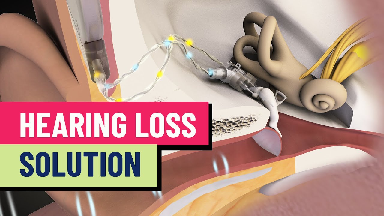 How Envoy Medical is disrupting the hearing loss industry