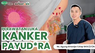 Penanganan Kanker Payudara K Sehat Metcovazin