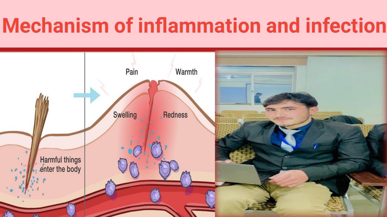 Mechanism of inflammation infection pathophysiology chapter:2 part:1 BSN third semester in pashtokmu