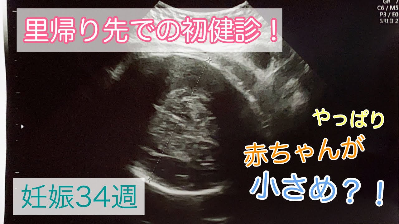 妊娠後期 里帰り出産 地元に戻りました 病院の違いや赤ちゃんの経過報告 Youtube