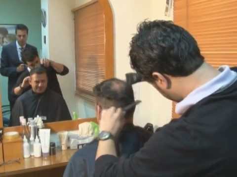 Haircut before FUE hair transplant surgery at HDC Clinic