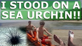 Standing on a Sea Urchin | Thailand VLOG #4