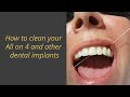 How to clean your All on 4 and other Dental Implants