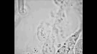 Micromanipulation Microscope 1.5 nucleus isolation