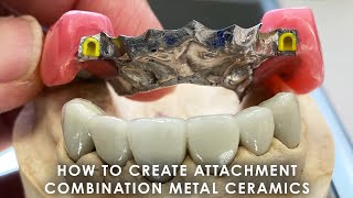 Download Lagu Hoe je Attachment Combination Metal Ceramics maakt MP3