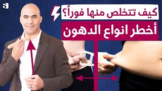 اسرع طريقة للتخلص من الدهون | اخسر دهون تحت الجلد و دهون البطن الحشوية نهائيا بطرق مثبتة