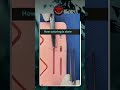 How Suturing Is Done Drmuhammedziya Sutur Suturing Surgery Doctor 