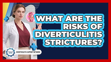 What Are The Risks Of Diverticulitis Strictures?