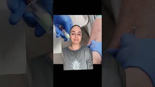 COMMON IV MISTAKES: Tips & Tricks