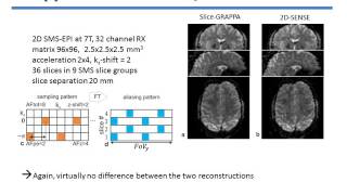 Benjamin Zahneisen: SENSE and Simultaneous Multislice Imaging