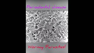 Periodontal disease? Wormy parasites!