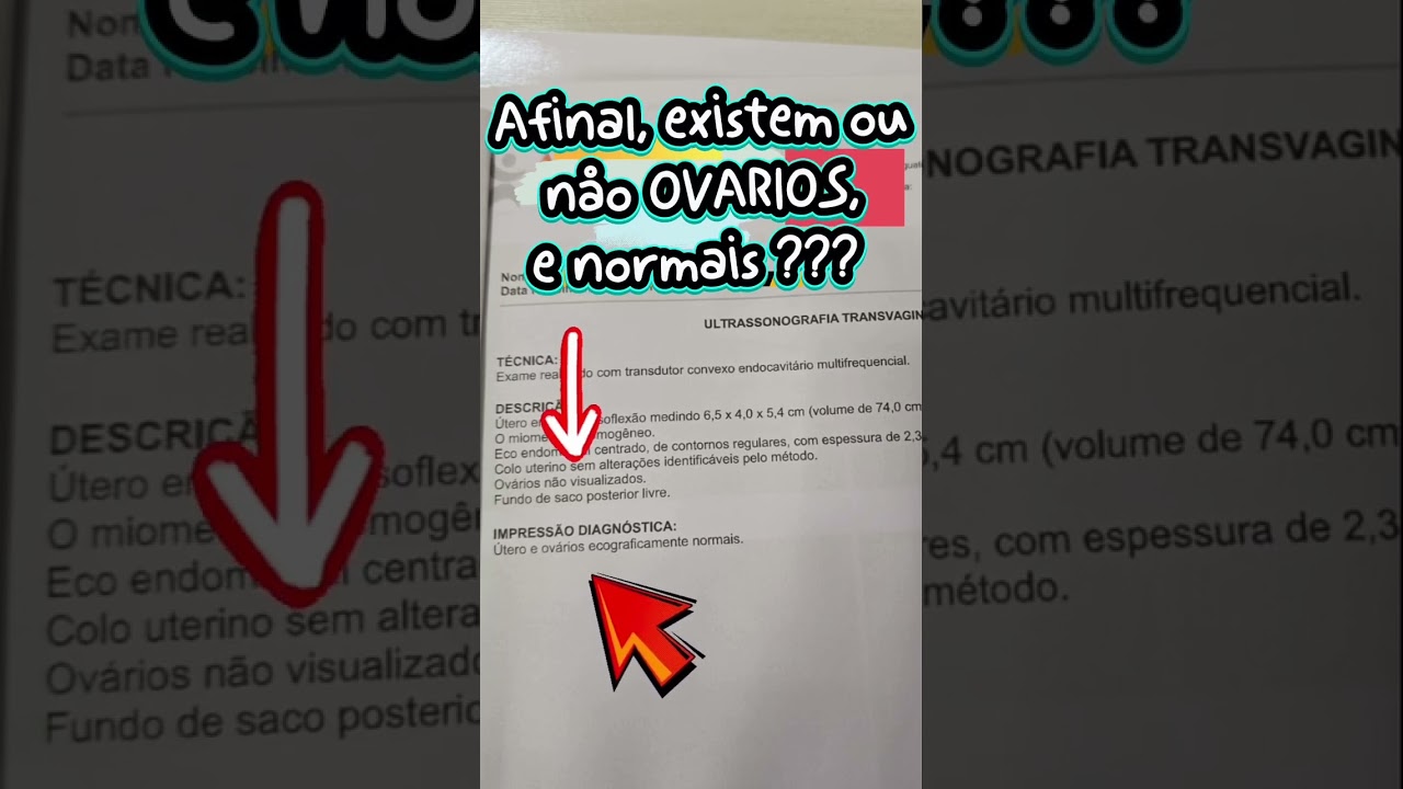 😂 Agora a NASA vem! - #momentohumor