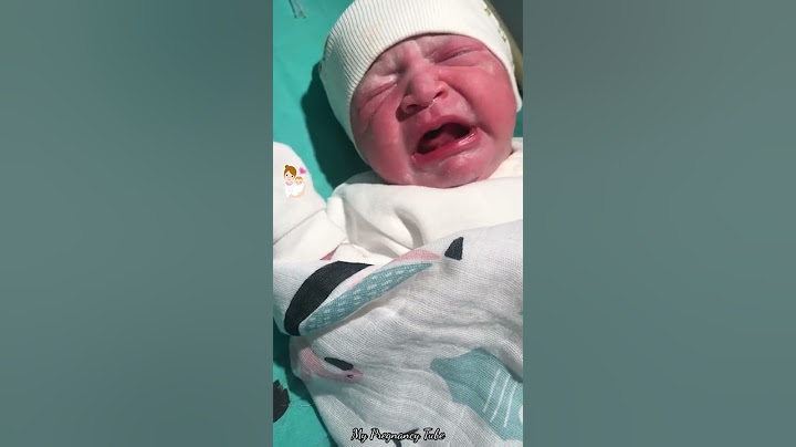 يا عمري 🥺 اطفال حديثي الولادة 💙