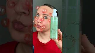 😳 Прыщи, жирный блеск и забитые поры? Набор от акне Cosmeya WW139065 арт WB ✨