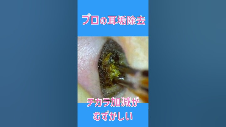 耳そうじ   セッシと吸引　#shorts