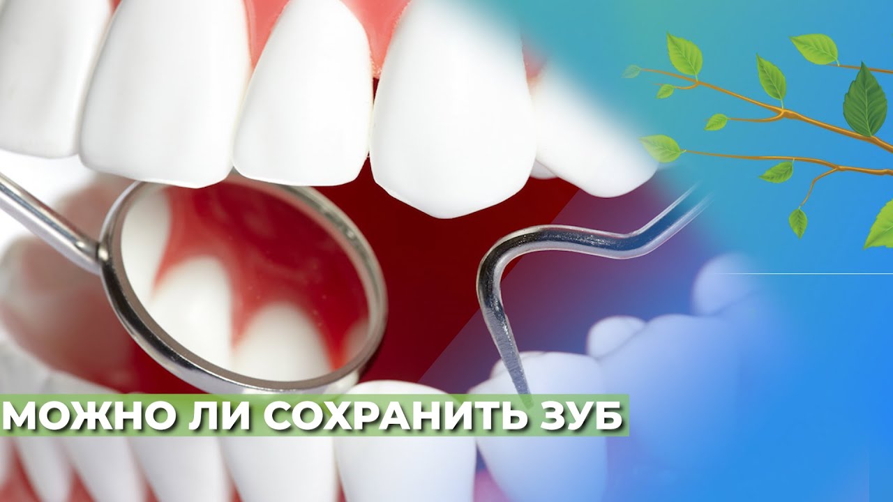 В каких случаях можно ли сохранить зуб☘️ - YouTube