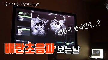 VLOG2 / 배란초음파 확인하고왔어요... 배란실패? | 임신준비 브이로그 | 예비맘 | 임신