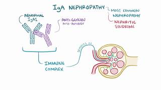 IgA nephropathy Berger disease   causes, symptoms, diagnosis, treatment, pathology
