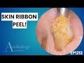 Skin Ribbons, Dark Ear Wax & Chunky Plugs! - EP1212