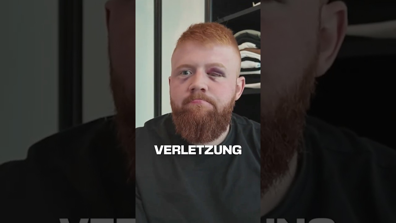 Kein Boxkampf für MckyTV🤕