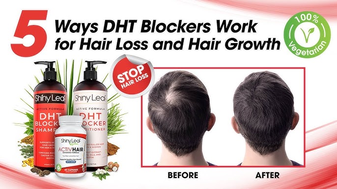 Hair Loss Treatment for Men & Women - DHT Blocker Shampoo & Conditioner -  YouTube