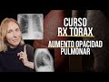 ¿Sabes leer una radiografía de tórax? Empecemos!