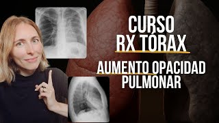 ¿Sabes leer una radiografía de tórax? Empecemos!