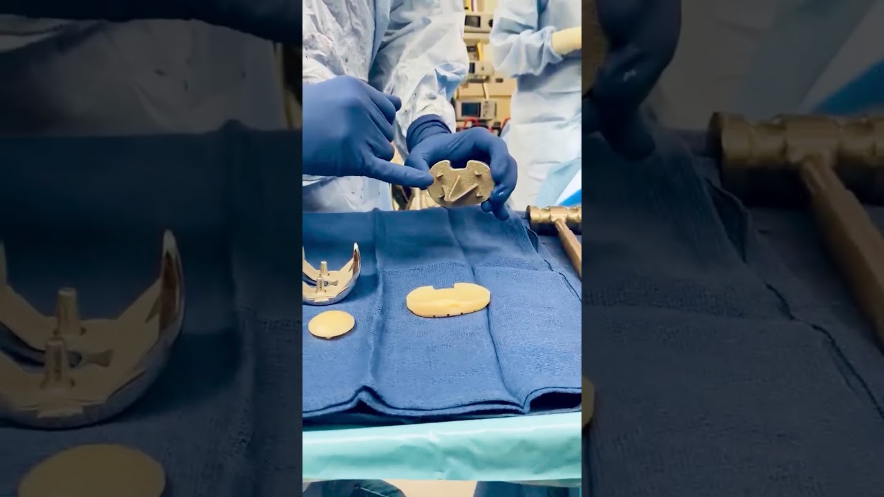 Press fit / cementless knee replacement