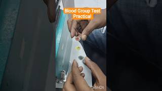 Blood Group Test Practical #lablife #labtechnician #dmlt