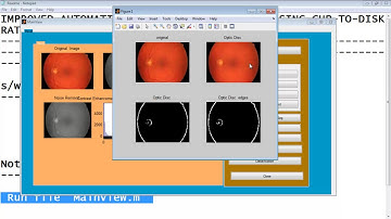 Glaucoma Detection  Cup to Disk Ratio Matlab Code Projects