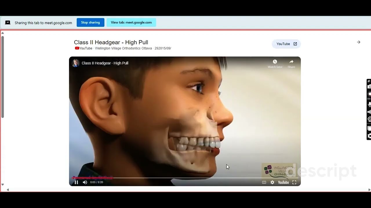 Orthodontic رفيع المقام 19 dr. Malaz شرح #برومترك