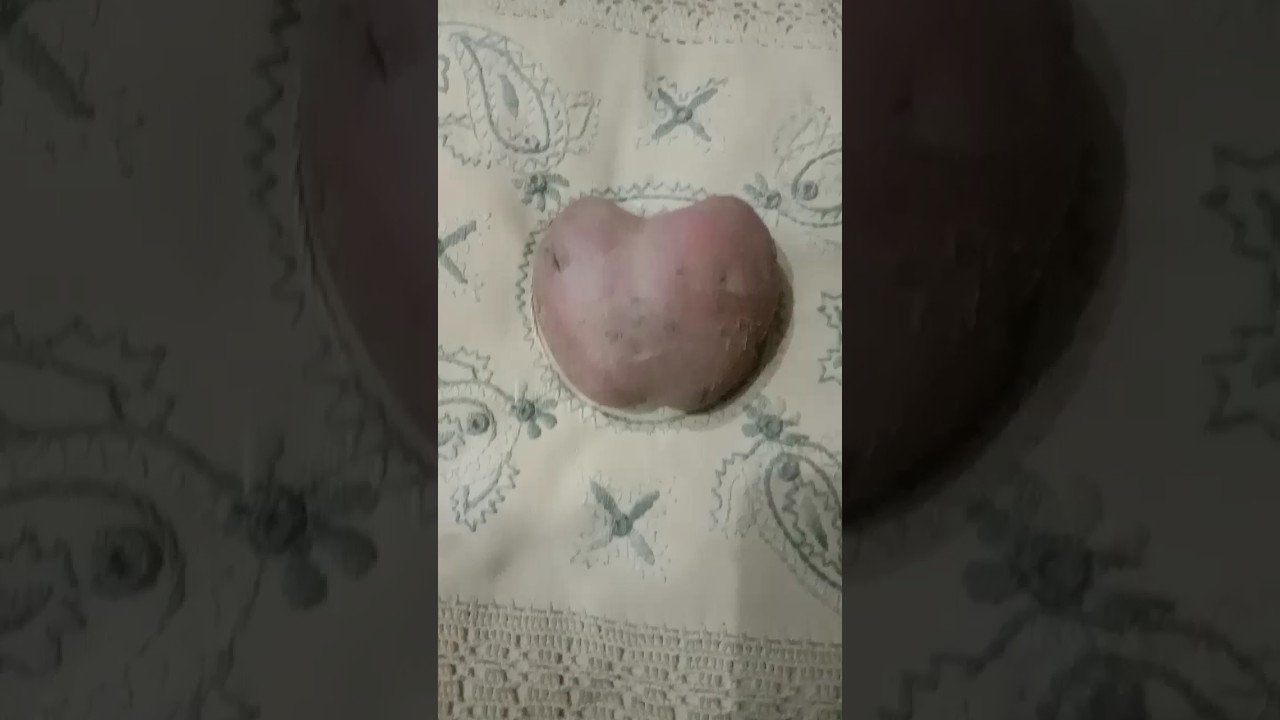 What is this Potato🥔, Apple🍎or Heart ❤ Tell me in Comments 👉 