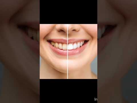التدخين اي اللي مستنيك بعد أول سيجاره
