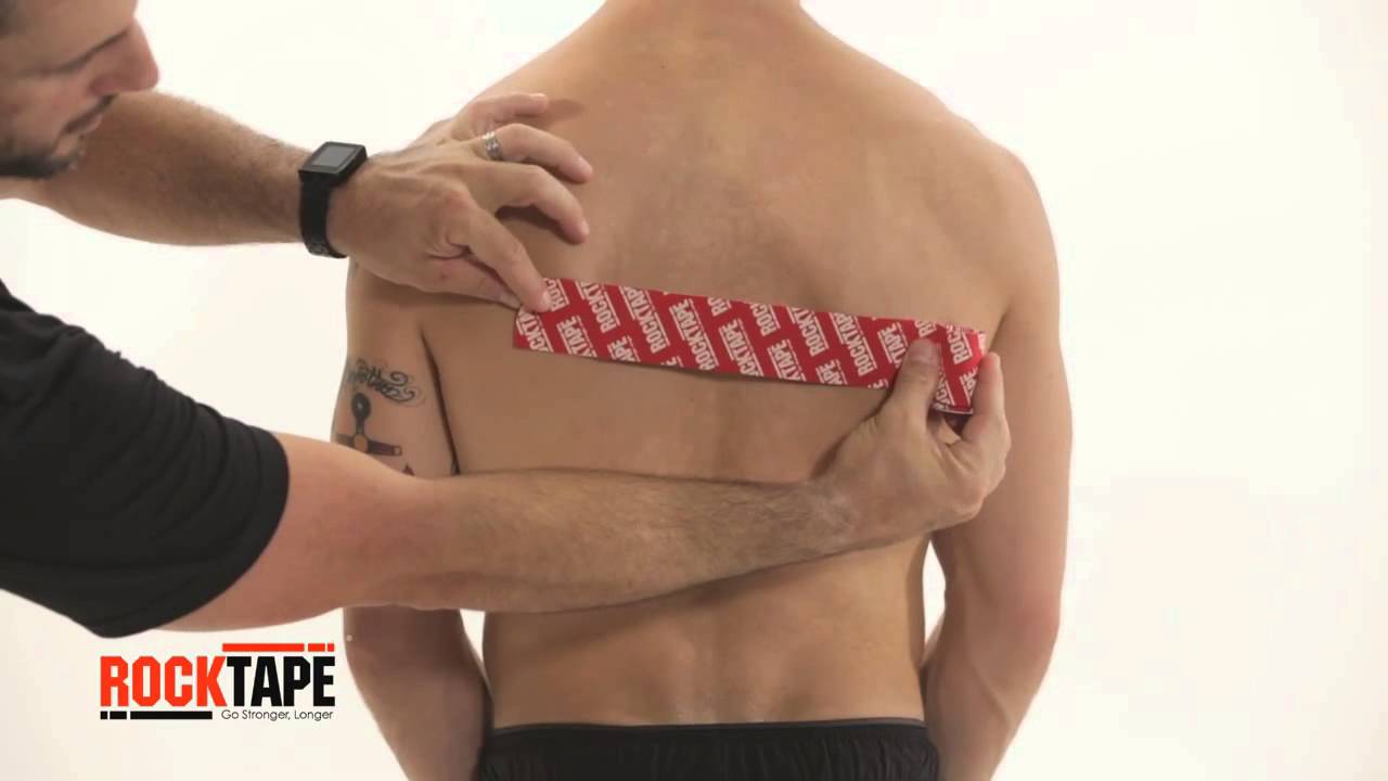 Схема тейпирования спины при болях в пояснице