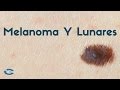 Melanoma y lunares en la piel
