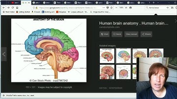 [MIRROR] Human brain changes part 6, Amygdalas, Putamen, Corpus callosum, Fornix Mandela Effects