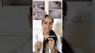 The Skin Sign Every MBBS Student Must Know 🔥 | Nikolsky Sign Explained