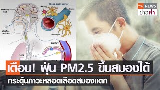 เตือน! ฝุ่น PM2.5 ขึ้นสมองได้ กระตุ้นภาวะหลอดเลือดสมองแตก  | TNN ข่าวค่ำ | 5 ก.พ. 66
