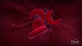 Enfermedad de células falciformes  | Video HHMI BioInteractive